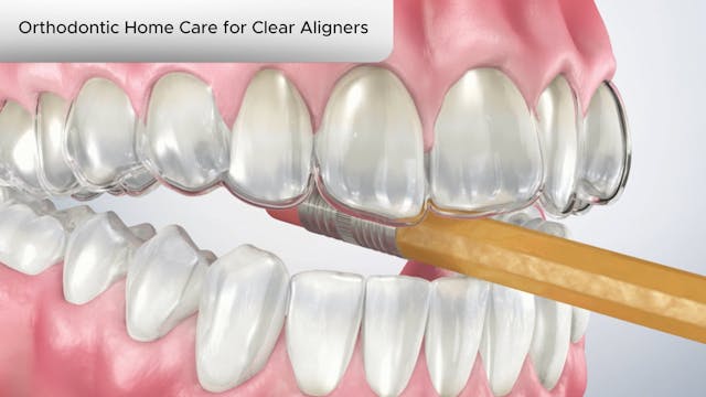 Orthodontic Home Care for Clear Aligners - Dental Patient Education Video