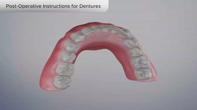 Post-Operative Instructions for Dentures