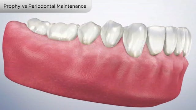 Prophy vs Periodontal Maintenance - Dental Patient Education Video