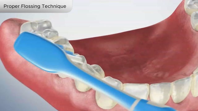 Proper Flossing Technique - Dental Patient Education Video