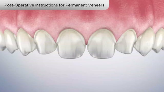 Post-Operative Instructions for Permanent Veneers-Dental Patient Education Video