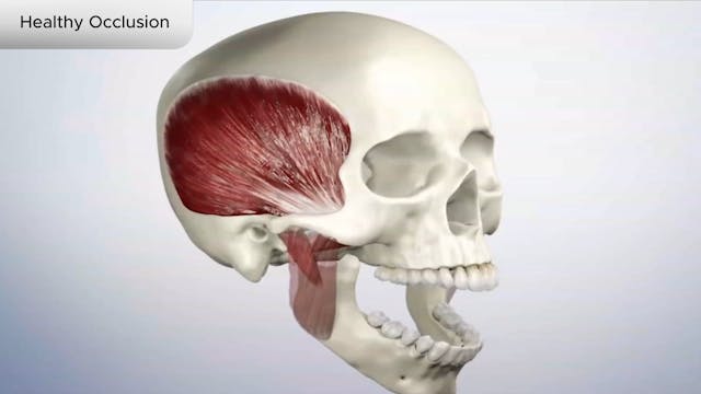 Healthy Occlusion - Dental Patient Education Video