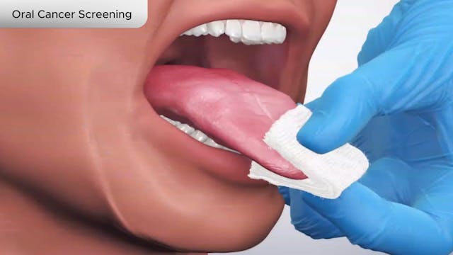 Oral Cancer Screening - Dental Patient Education Video