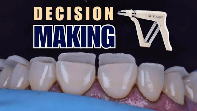 Decision Making for Anterior Composites