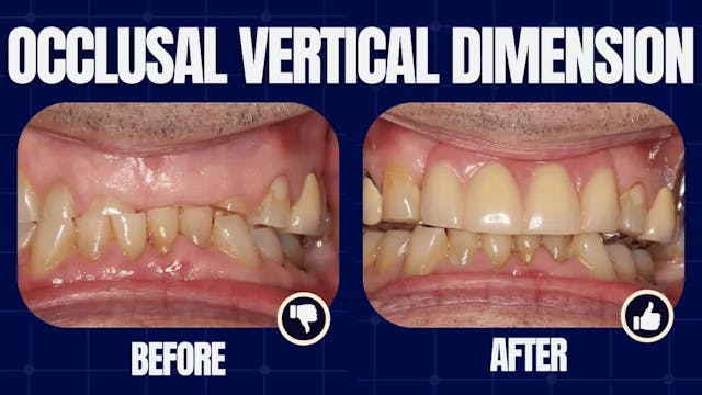 Understanding Vertical Dimension in D...