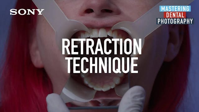 Dental Photography# Retraction Technique