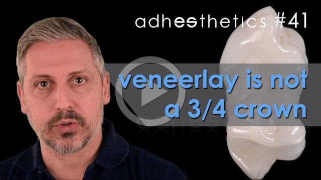 Veneerlay is not a 3 4 crown Episode #41