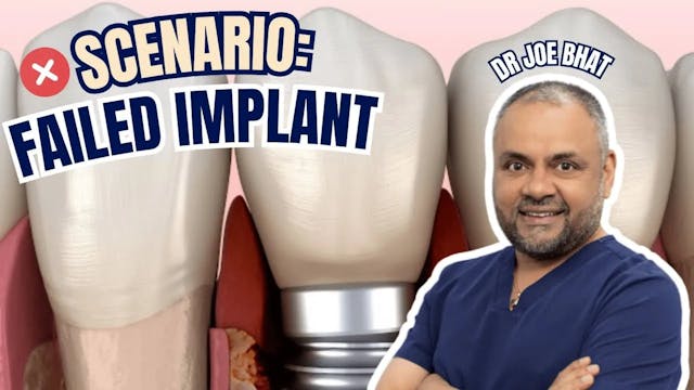 Navigating Dental Implant Failures: I...