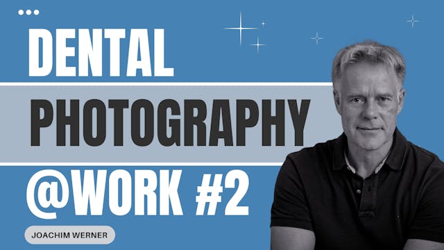 Dental Photography at Work part #2