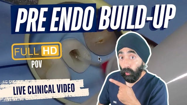 Pre-Endodontic Build Up FULL HD CLINI...