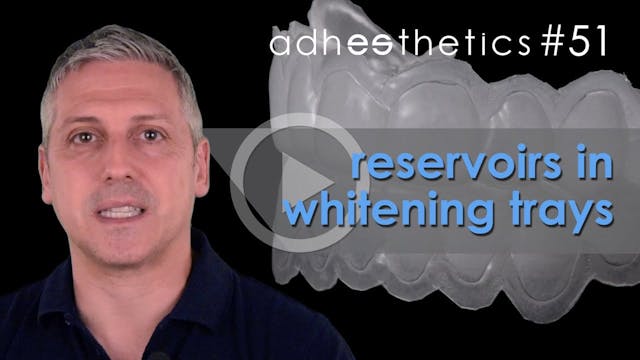 Reservoirs in whitening trays Episode...