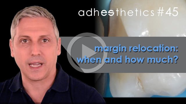 Margin relocation_ when and how much ...