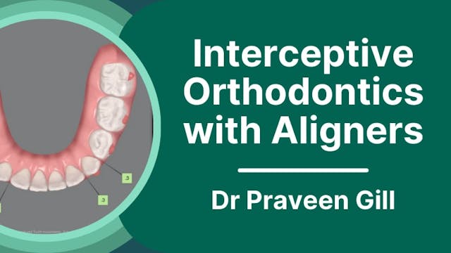 Understanding Interceptive Orthodonti...