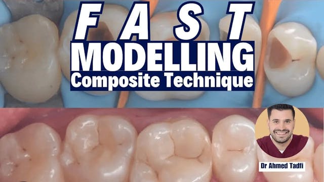 Mastering Posterior Composites: Techn...