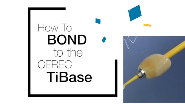 Bonding to the TiBase