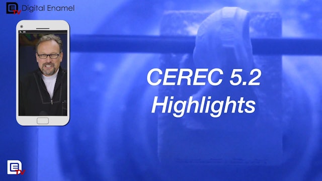 CEREC 5.2 Update