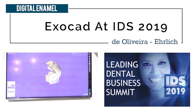Exocad at IDS