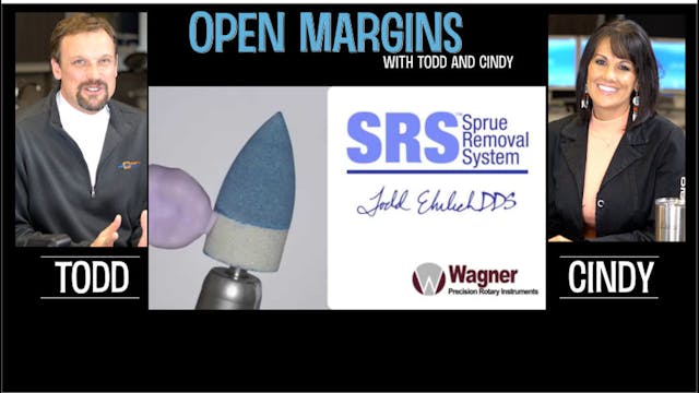 Open Margins Sprue Removal System