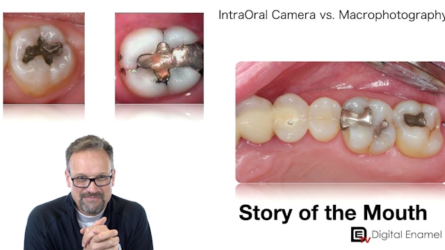 The Story of the Mouth:  Dental Photography