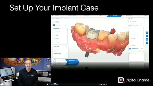 CEREC Implants Set Up the Impant Case