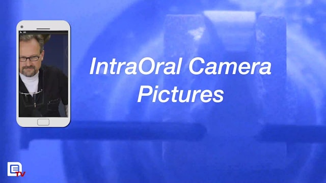 Where Are the IntraOral Camera Pictures?