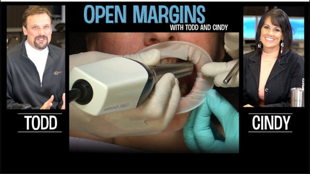 CEREC Ortho and Open Margins