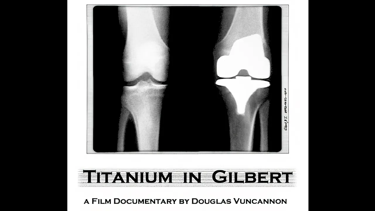 Titanium in Gilbert (2002)