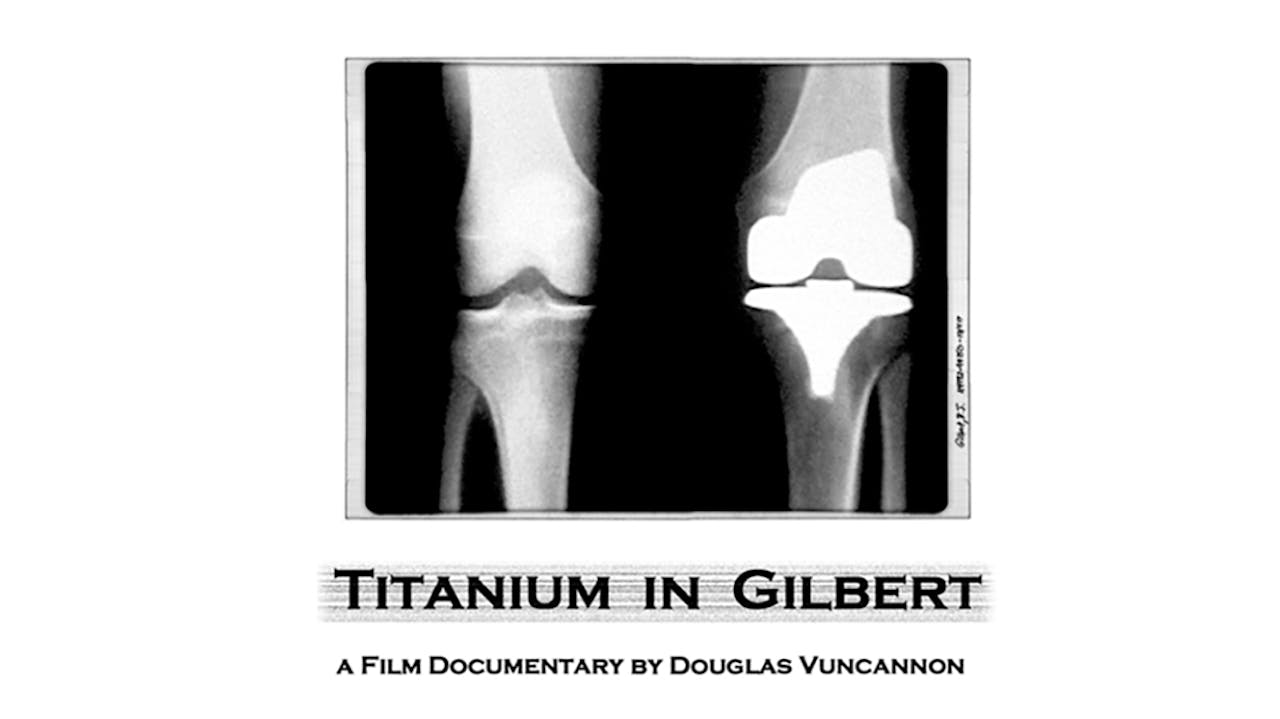 Titanium in Gilbert (2002)