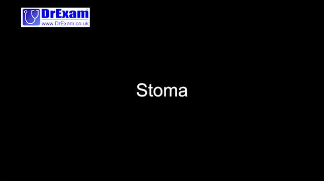 Stoma