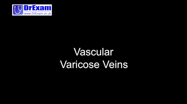 Vascular - Varicose Veins