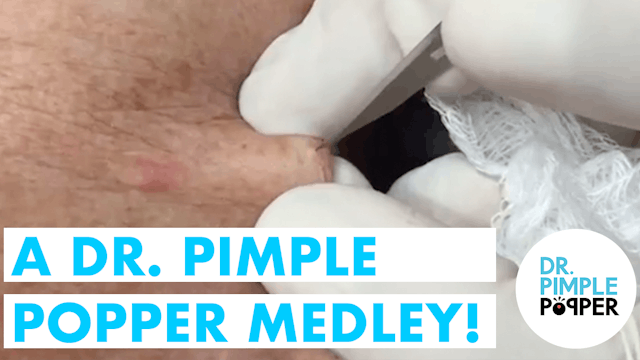 A Dr Pimple Popper Medley!
