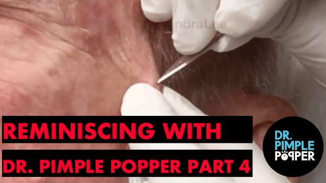 Reminiscing with Dr Pimple Popper, Pa...