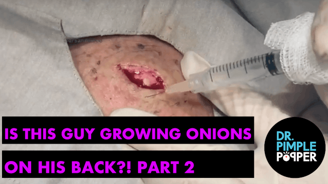 Is this guy growing onions in his bac...
