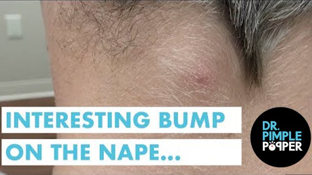 An Interesting Bump on the Nape...