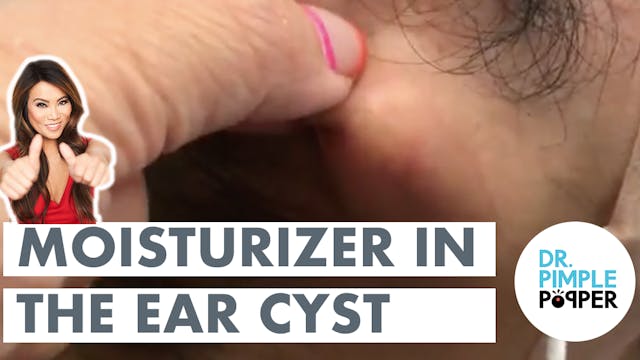 Moisturizer In The Ear Cyst
