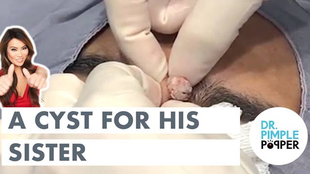 A Cyst for His Sister