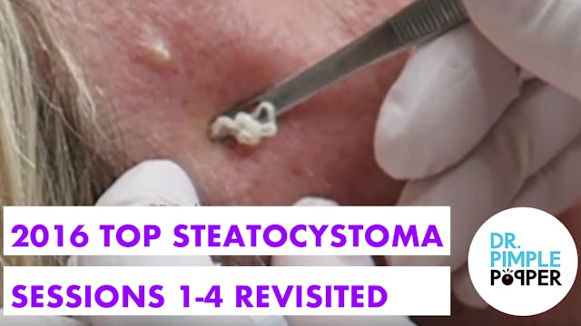 2016 Top Steatocystomas Sessions 1-4 ...