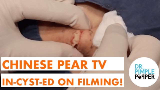 Chinese Pear TV inCYSTed on Filming