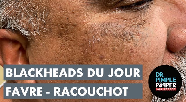 Blackheads Du Jour: Favre-Racouchot