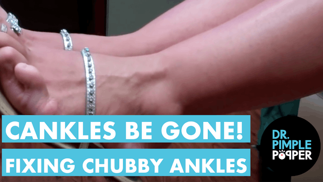 Cankles Be Gone! Dr. Sandra Lee to Fi...