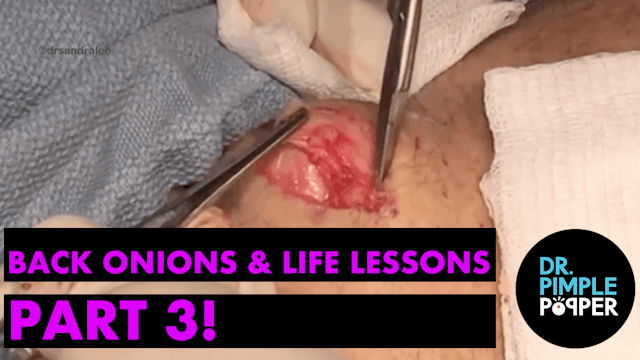 Back Onions & Life Lessons: Part 3 wi...