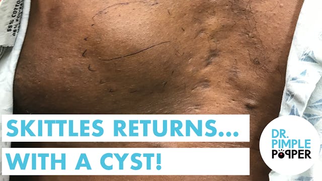 Skittles Returns with a Big Cyst!