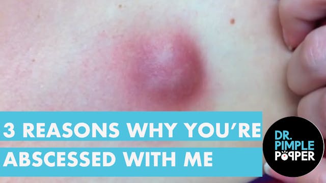 THREE reasons why you're ABSCESSED wi...