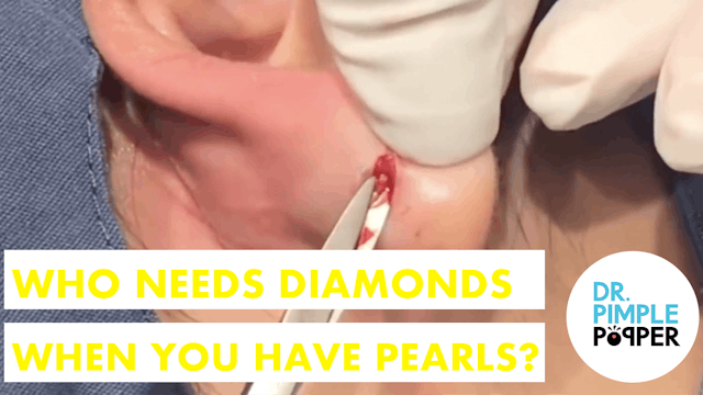 Who Needs Diamonds When You Have Pearls?