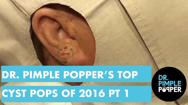 Dr Pimple Popper's Top 10 Cyst POPS o...