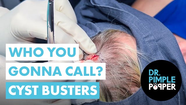 Who You Gonna Call? Cyst Busters