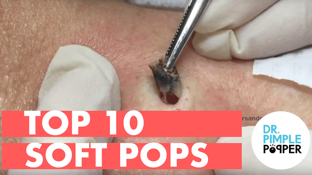 Top 10 Softpops of 2015 (Part 1)