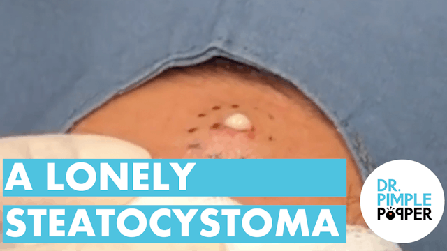 A Lonely Steatocystoma