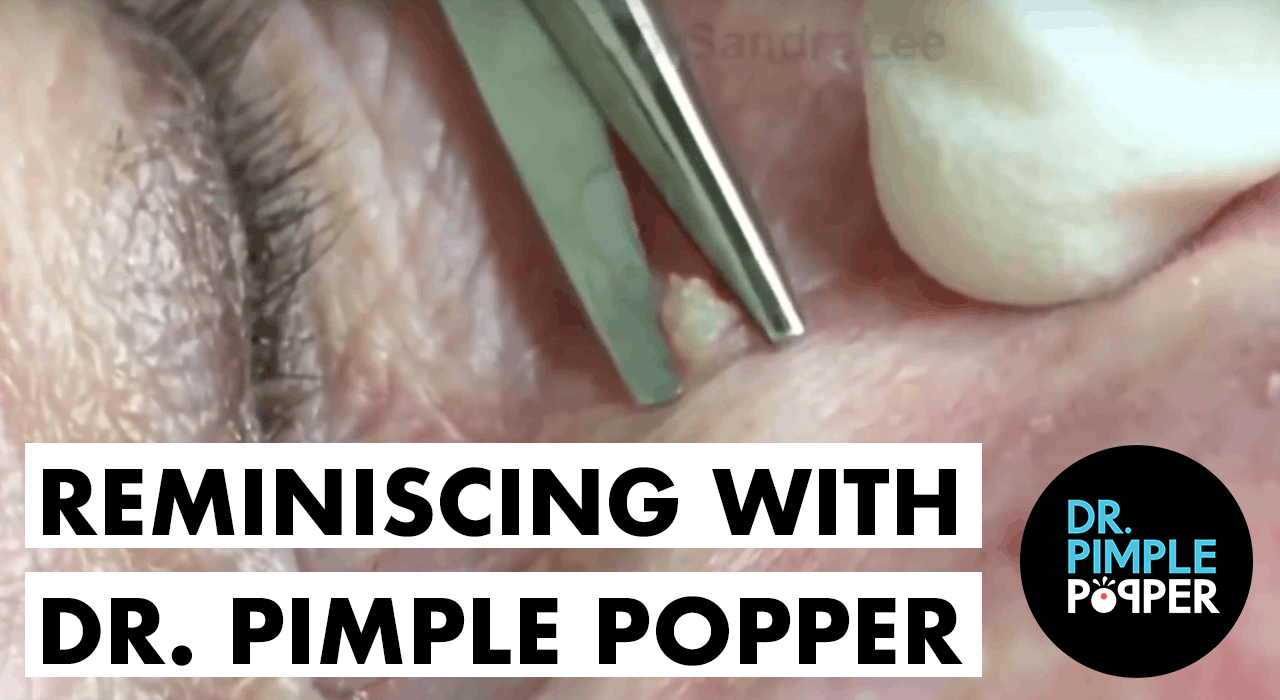 Reminiscing With Dr Pimple Popper Tbt
