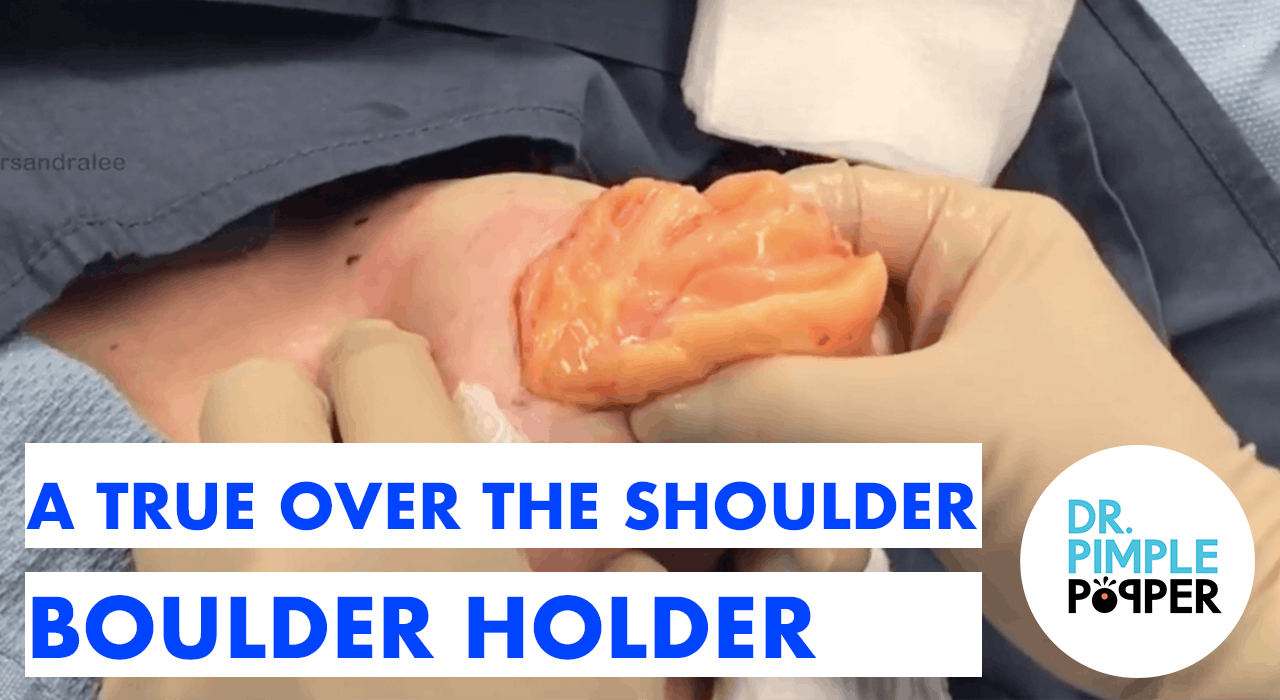 Boulder Holder